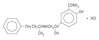 structural formula labetalol hcl